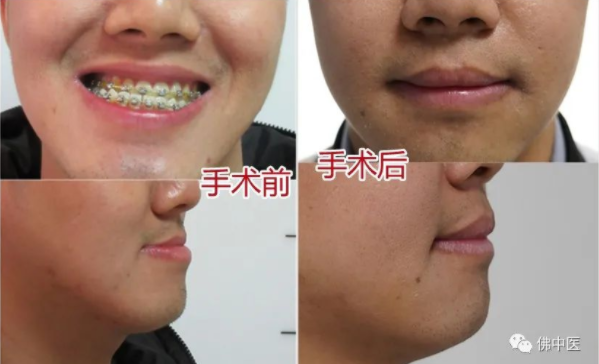 微信截圖_20230322131021.png